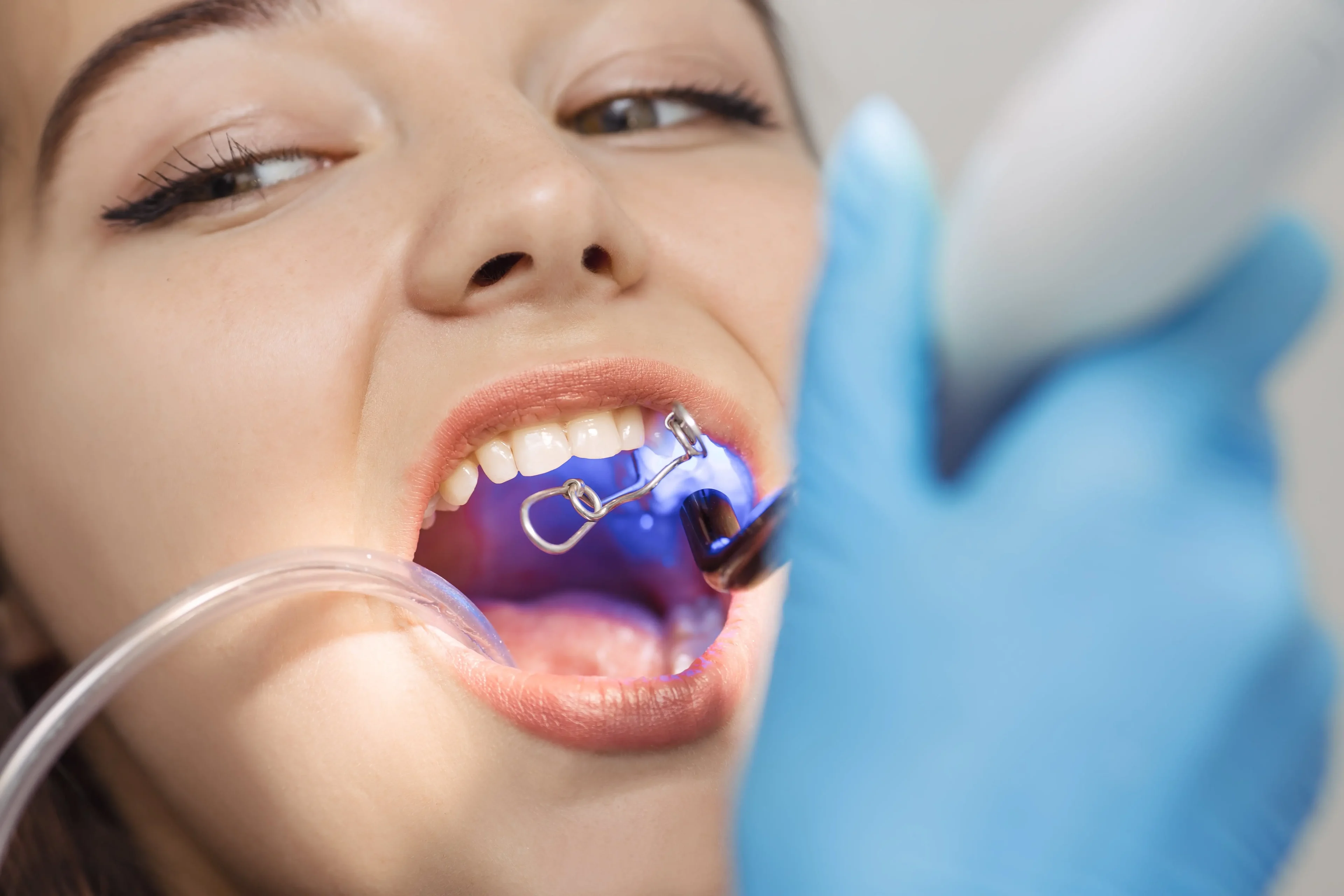 Dental procedure with curing light